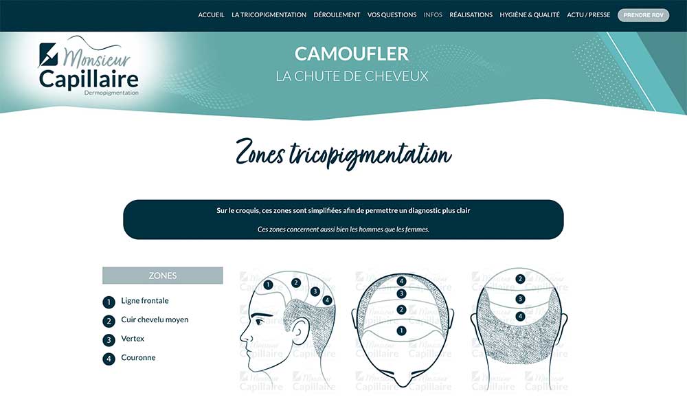création site web tricopigmentation 95